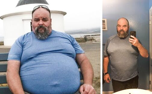 Nuotrauka prieš ir po „Keto Probiotix“ kurso, kapsulių naudojimo su migteriu iš Venecijos patirtis